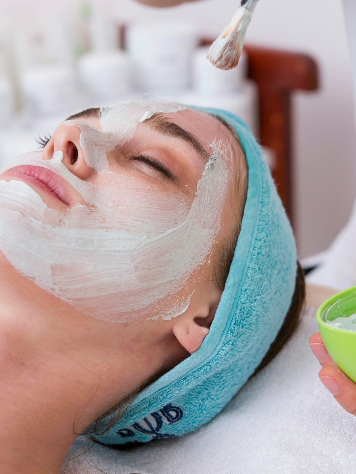 Chemical Peels